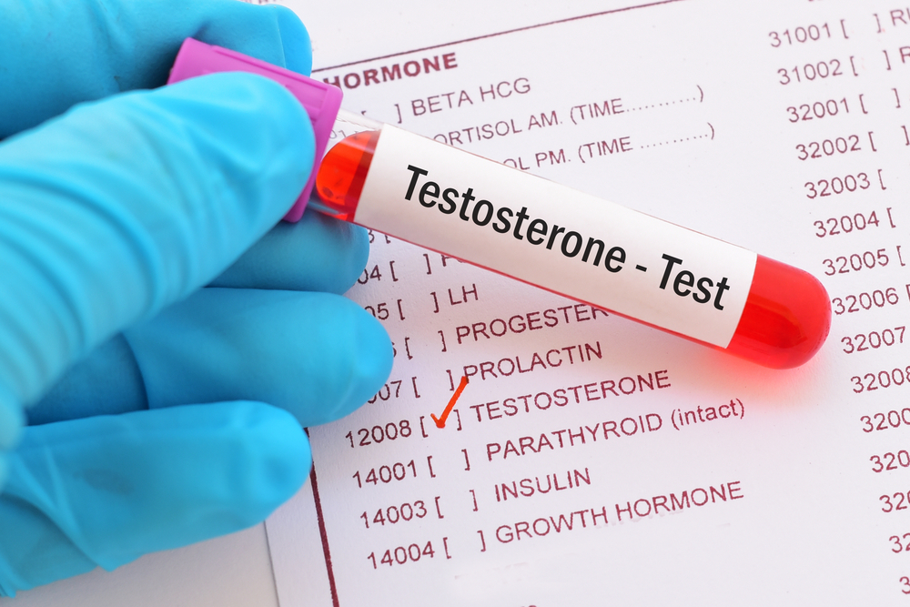 Your Comprehensive Guide to Testosterone for Men in Orlando